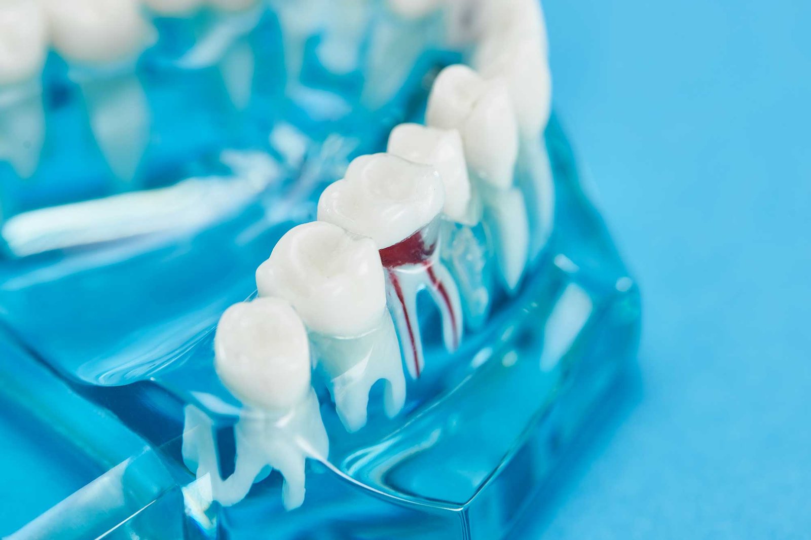 carrossel-endodontico1