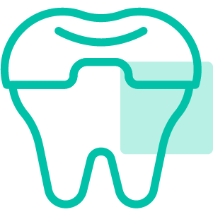 Restauração Dentária